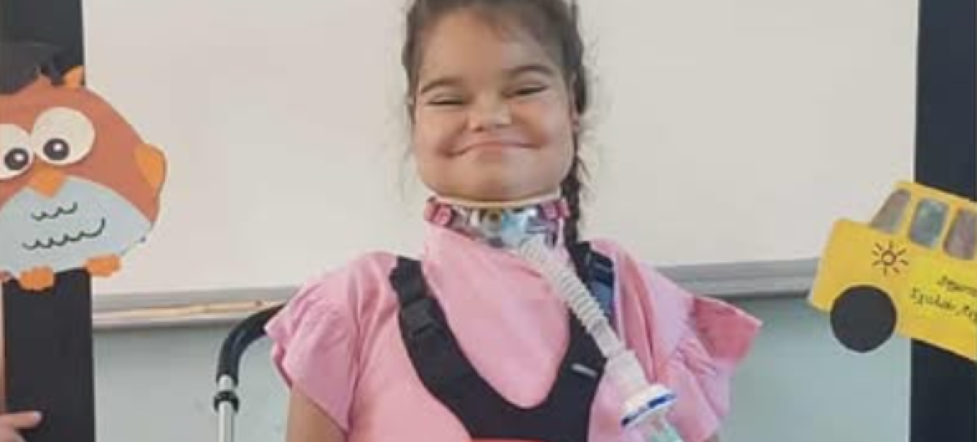 Ένας αγώνας που δεν πρέπει να δοθεί μόνος: Η μικρή Όλγα από την Κόρινθο χρειάζεται τη στήριξή μας